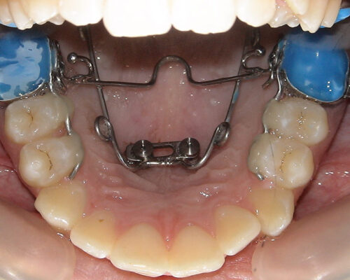 System-Benefit-ortodoncja-1